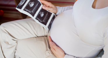 סקירת מערכות מוקדמת - סקירה ראשונה